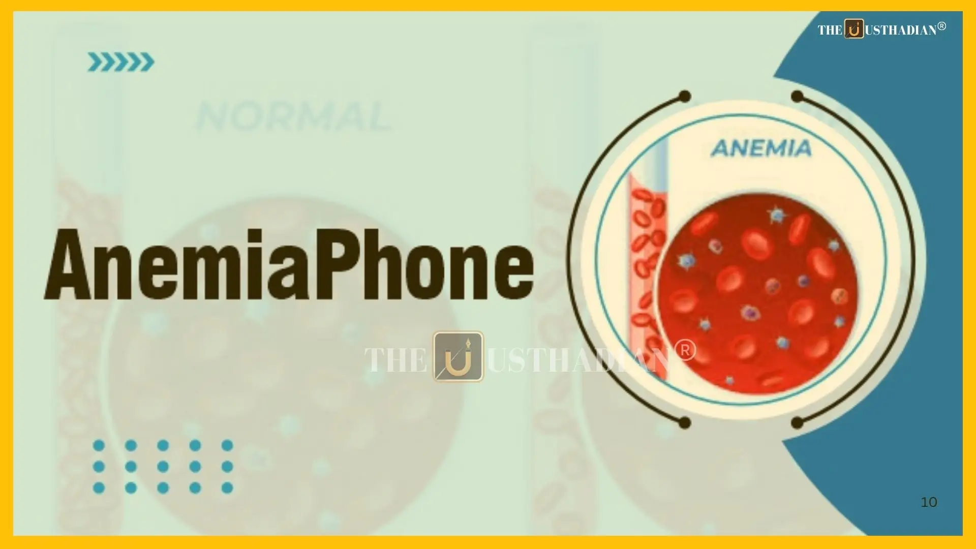 AnemiaPhone: A Tech Breakthrough in India’s War on Anaemia