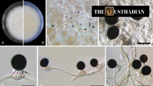 Epicoccum indicum: A New Fungal Threat to Medicinal Plant Vetiver Identified