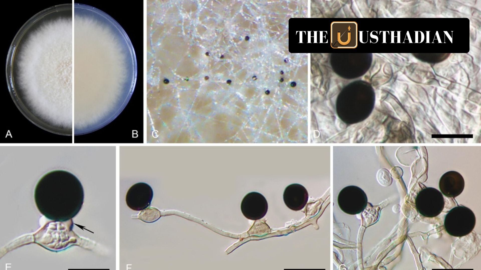 Epicoccum indicum: A New Fungal Threat to Medicinal Plant Vetiver Identified