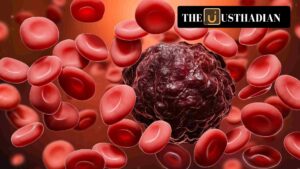 Qartemi: India’s First CAR-T Cell Therapy for Blood Cancer