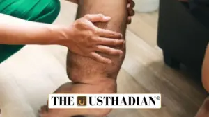 Nationwide Campaign for Lymphatic Filariasis Elimination Begins