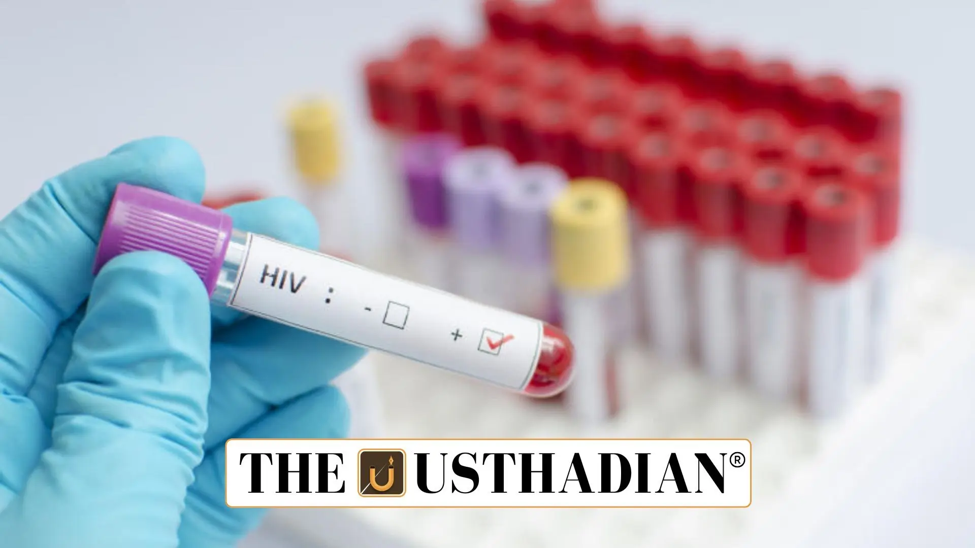 HIV Self-Testing Emerges as a Game-Changer in Mizoram’s Youth Health Crisis