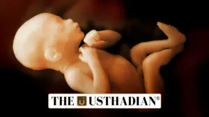 Ground-breaking Prenatal Treatment Offers New Hope for Spinal Muscular Atrophy