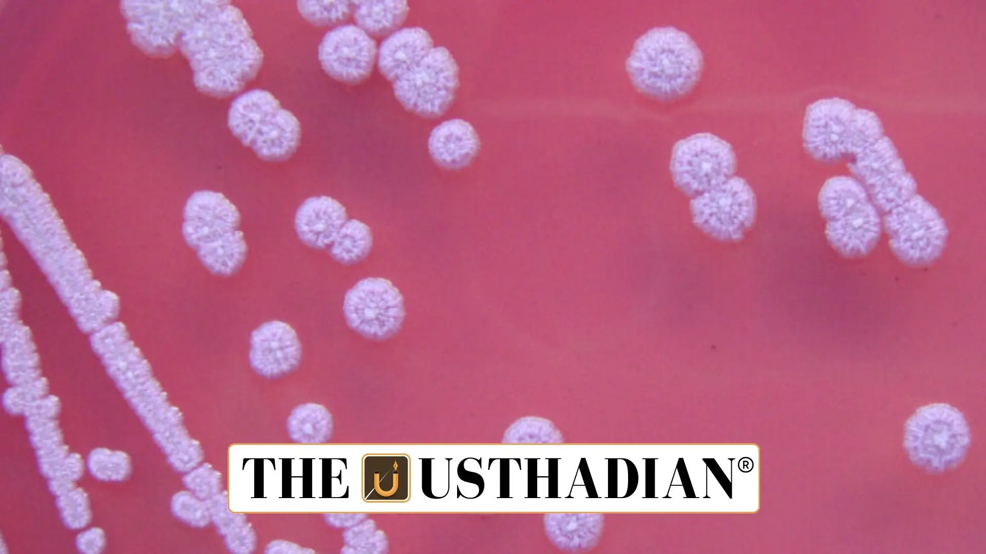 Melioidosis in Odisha: Climate-Linked Disease Emerges as Public Health Concern
