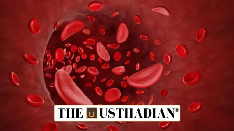 India hits milestone in Sickle Cell Anemia screening drive