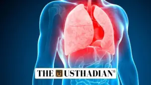Puducherry integrates TB screening into Family Adoption Programme