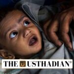 Stunting in India a Persistent Concern