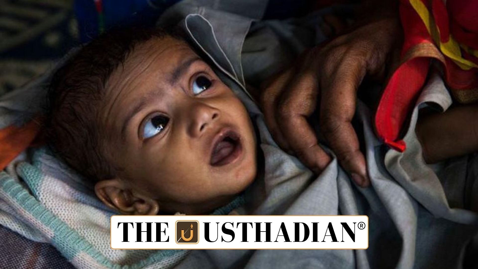 Stunting in India a Persistent Concern