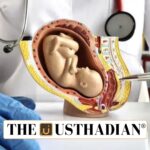 Rising Hysterectomy Rates in India