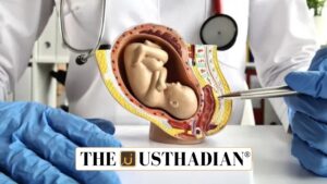 Rising Hysterectomy Rates in India