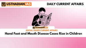 Hand Foot and Mouth Disease Cases Rise in Children