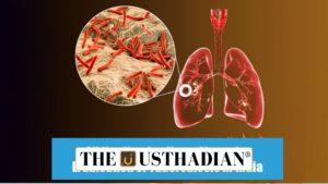 India’s Accelerated Progress Against Tuberculosis