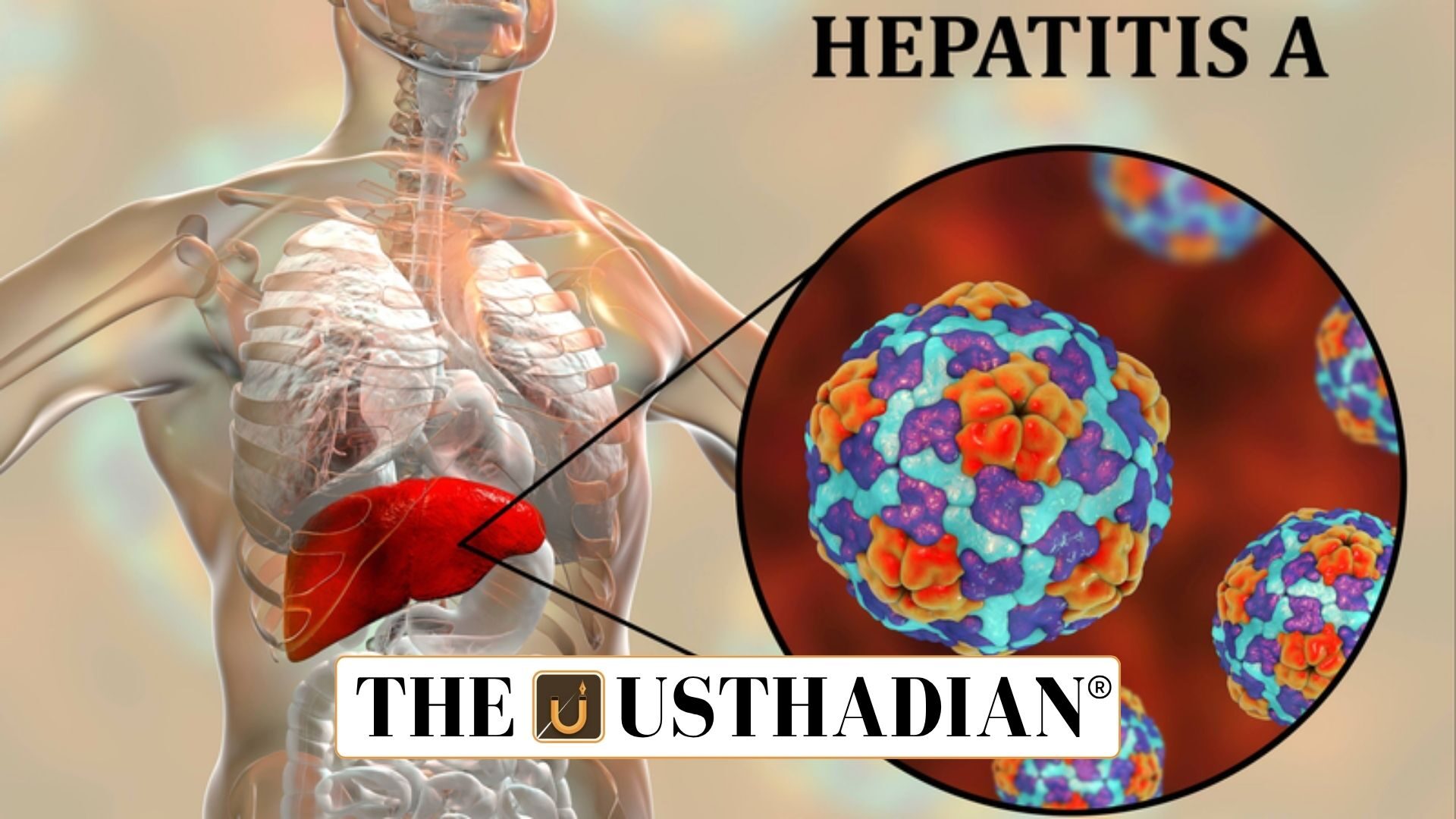 Rise of Hepatitis A Cases in India