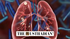India’s Steady Decline in Tuberculosis Burden