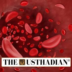 India hits milestone in Sickle Cell Anemia screening drive